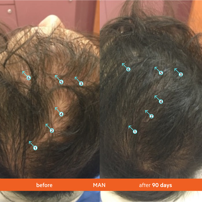 Revita 3 Pack - 3 Month Supply | Tablets For Hair Growth Support