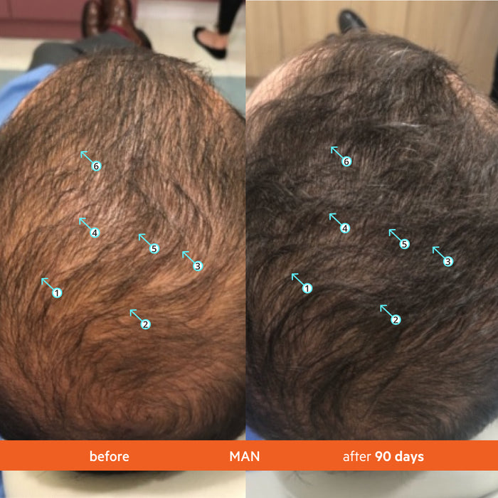 Revita 3 Pack - 3 Month Supply | Tablets For Hair Growth Support