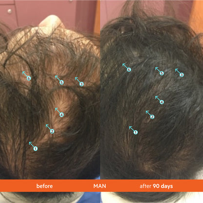 Revita 3 Pack - 3 Month Supply | Tablets For Hair Growth Support
